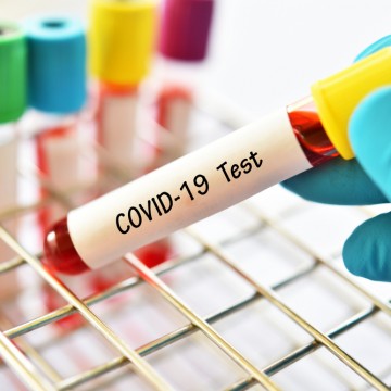 Coronavirus : ce qu’il faut savoir